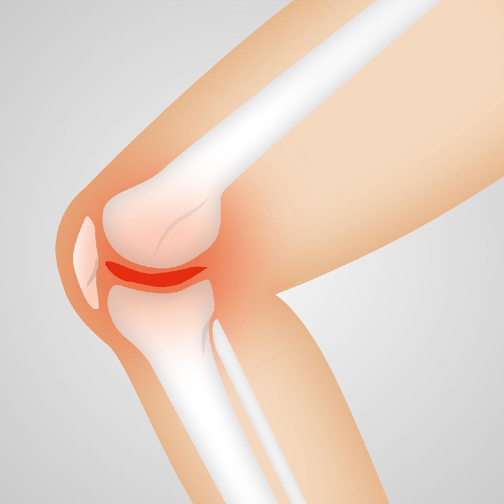Rekonwalescencja po artroskopii kolana